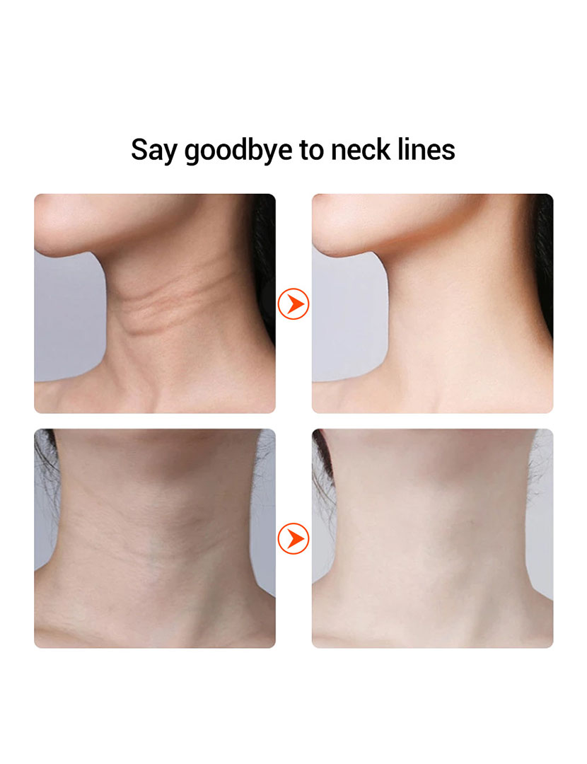 Dispositivo de Lifting Facial