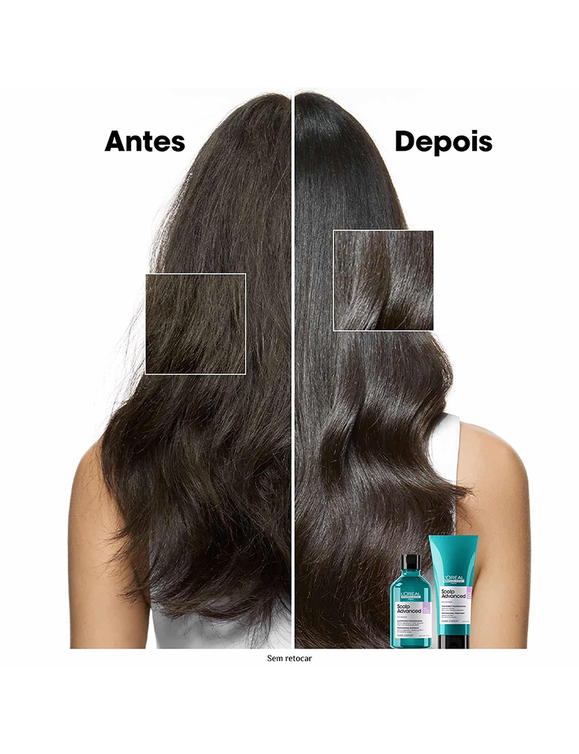Scalp Advanced Champô 