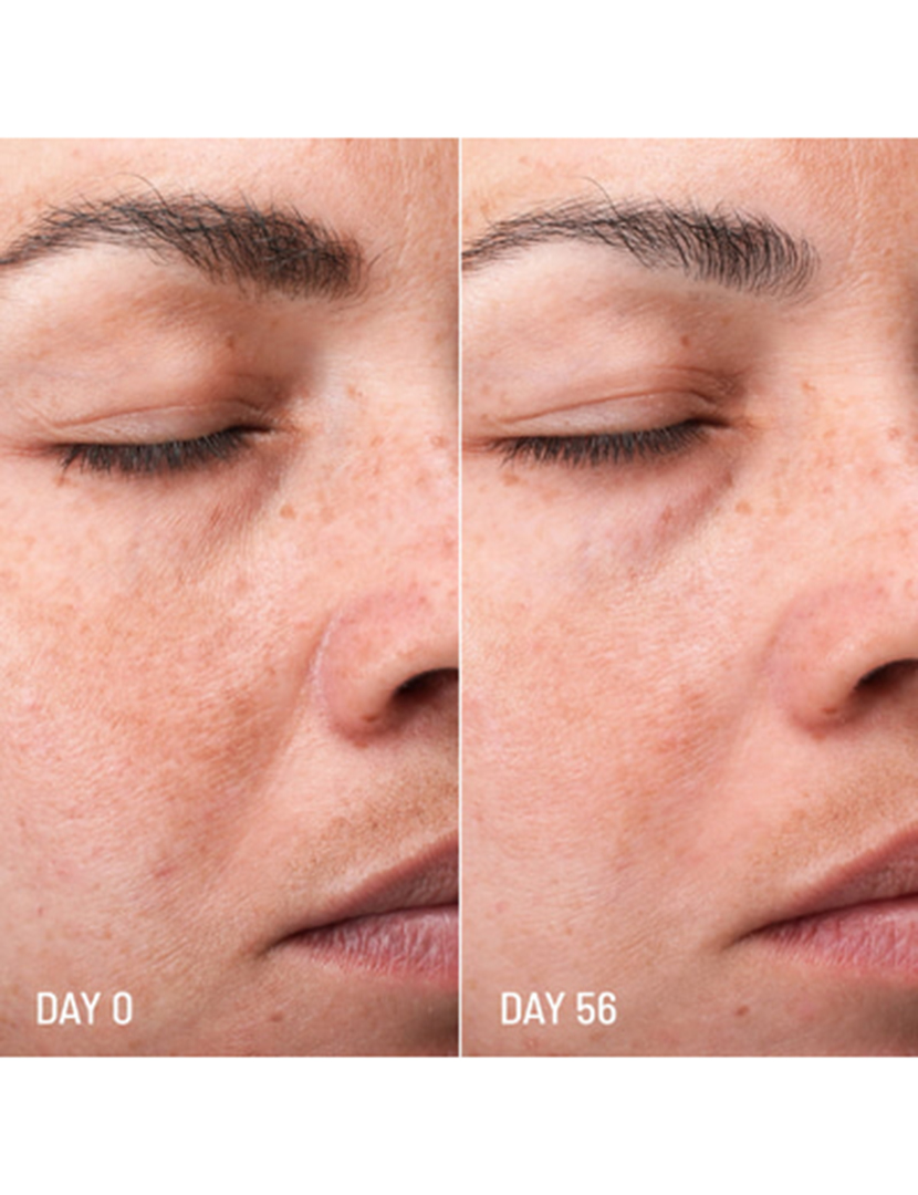 Lotus Radiance Darkspot Treatment, vista 3